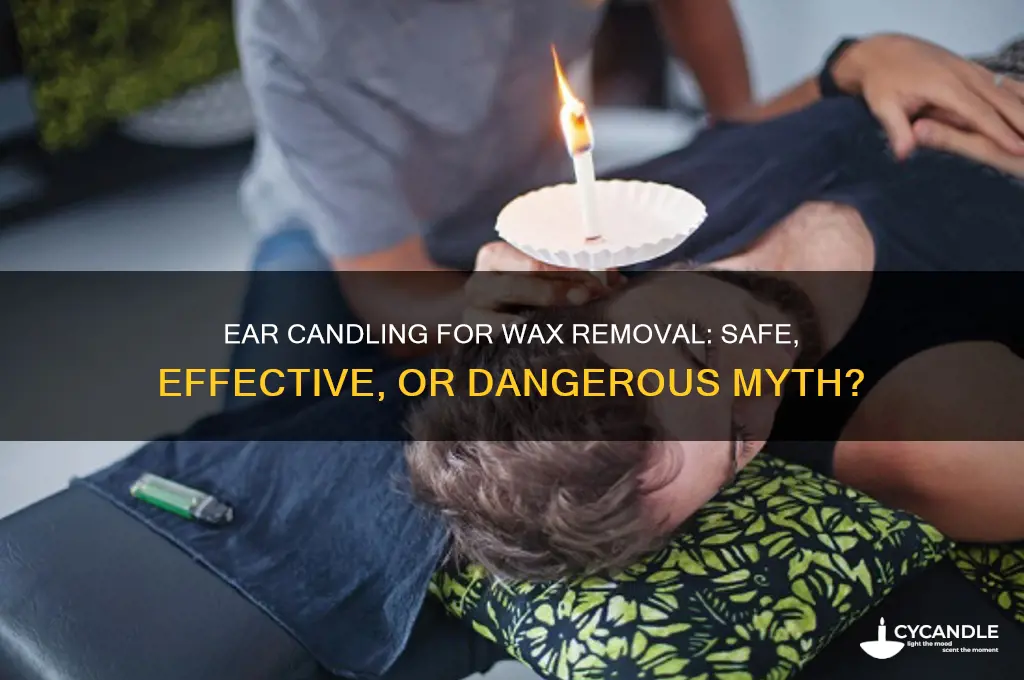 can you remove ear wax with a candle