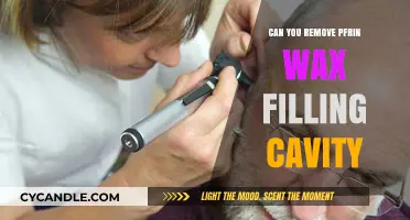 Removing PFRIN Wax Filling Cavities: Is It Possible and Safe?