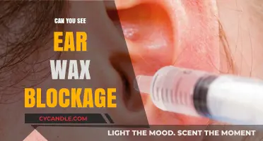 Can You See Ear Wax Blockage? Symptoms and Solutions Explained