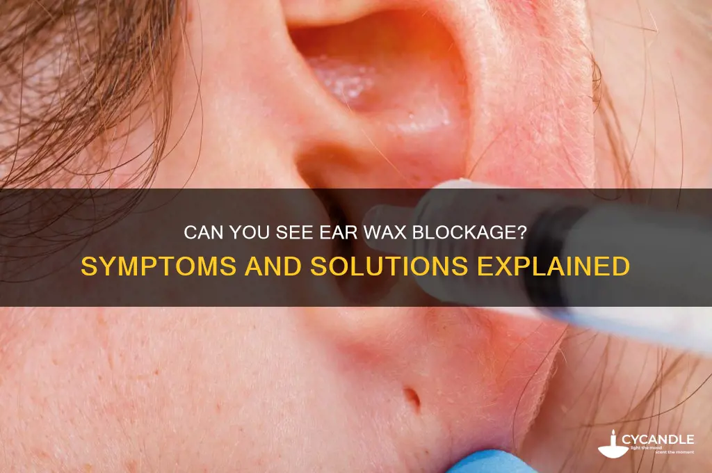 can you see ear wax blockage