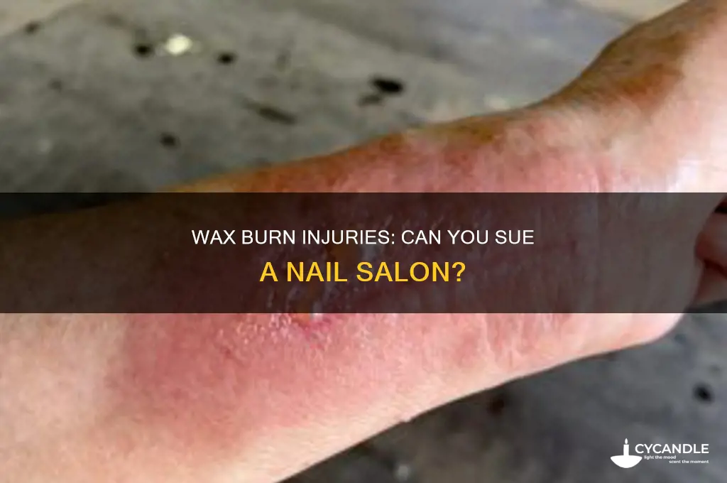 can you sue a nail salon for wax burn