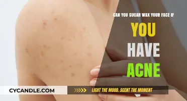 Sugar Waxing for Acne-Prone Skin: Safe Facial Hair Removal Tips