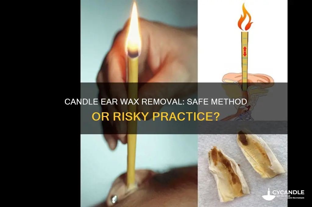 can you use a candle to remove ear wax