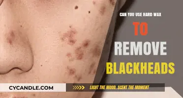 Hard Wax for Blackhead Removal: Effective Solution or Skin Risk?