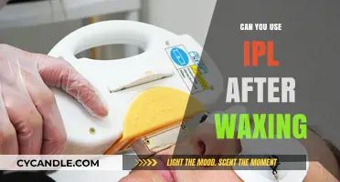 IPL After Waxing: Safe Skincare Tips for Smooth, Hair-Free Skin