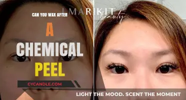 Waxing After a Chemical Peel: Safe Timing and Skin Care Tips