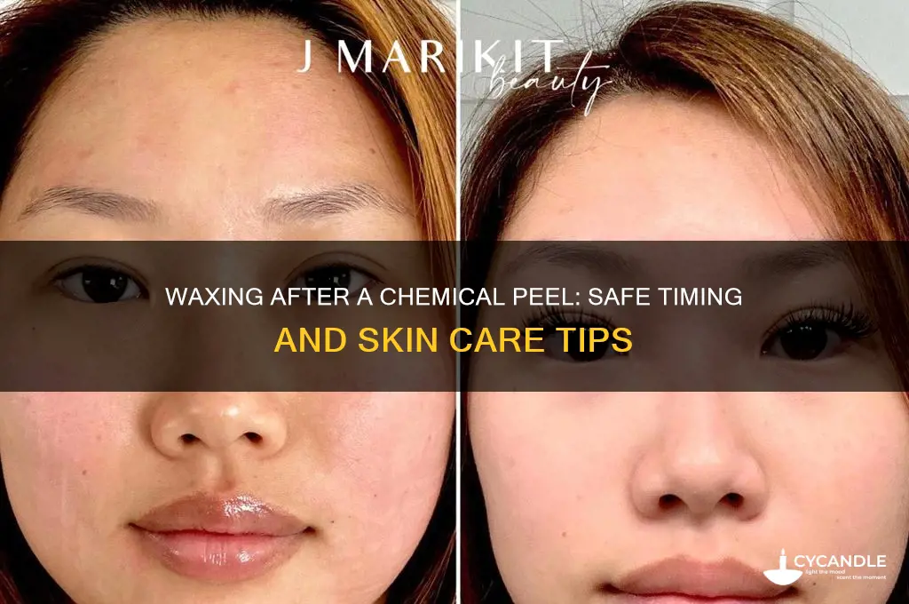 can you wax after a chemical peel