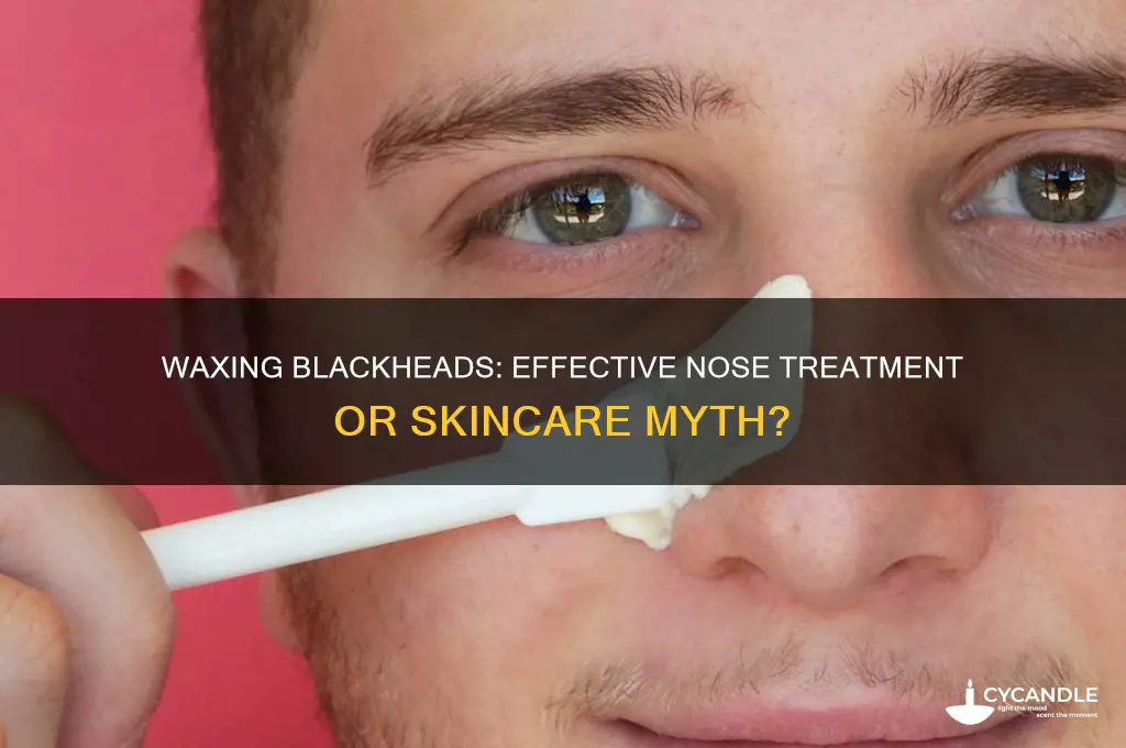 can you wax blackheads off your nose