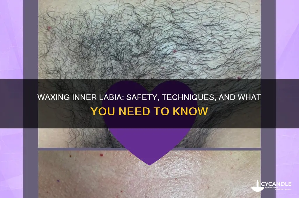 can you wax inner labia