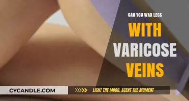 Waxing Legs with Varicose Veins: Safe or Risky Choice?