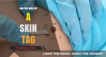 Can You Wax Off a Skin Tag? Risks and Alternatives Explained
