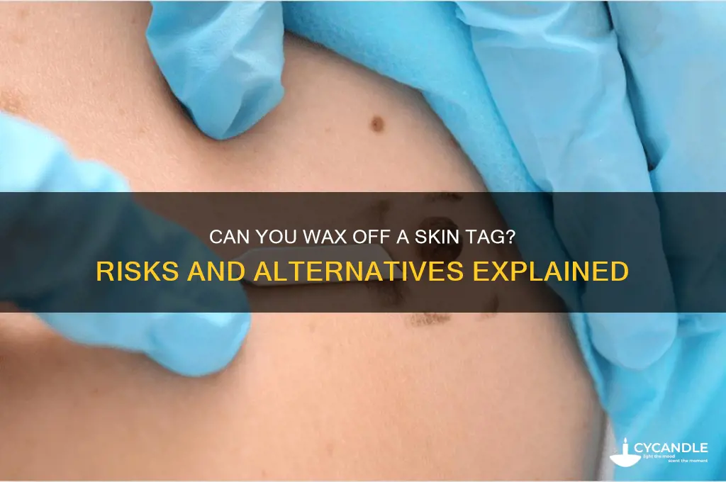 can you wax off a skin tag