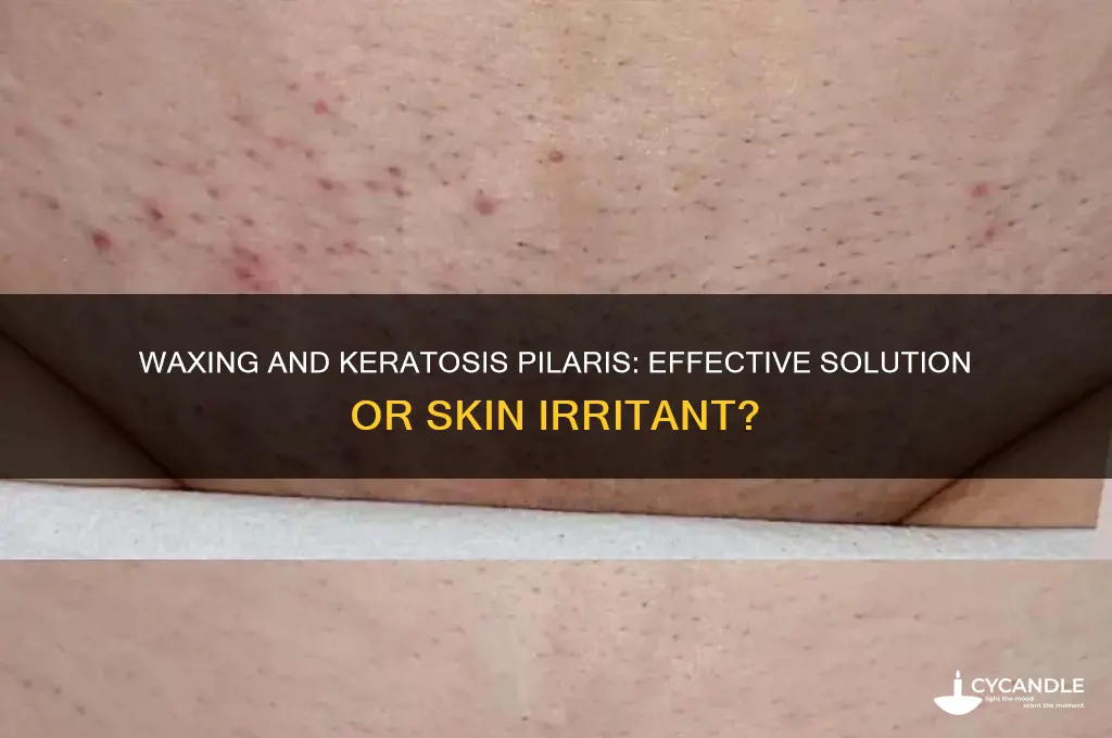 can you wax off kp