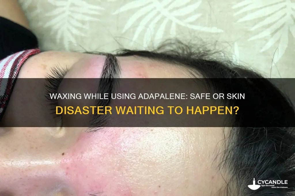 can you wax on adapalene