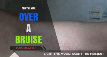 Waxing Over Bruises: Safe or Risky? Expert Advice Revealed