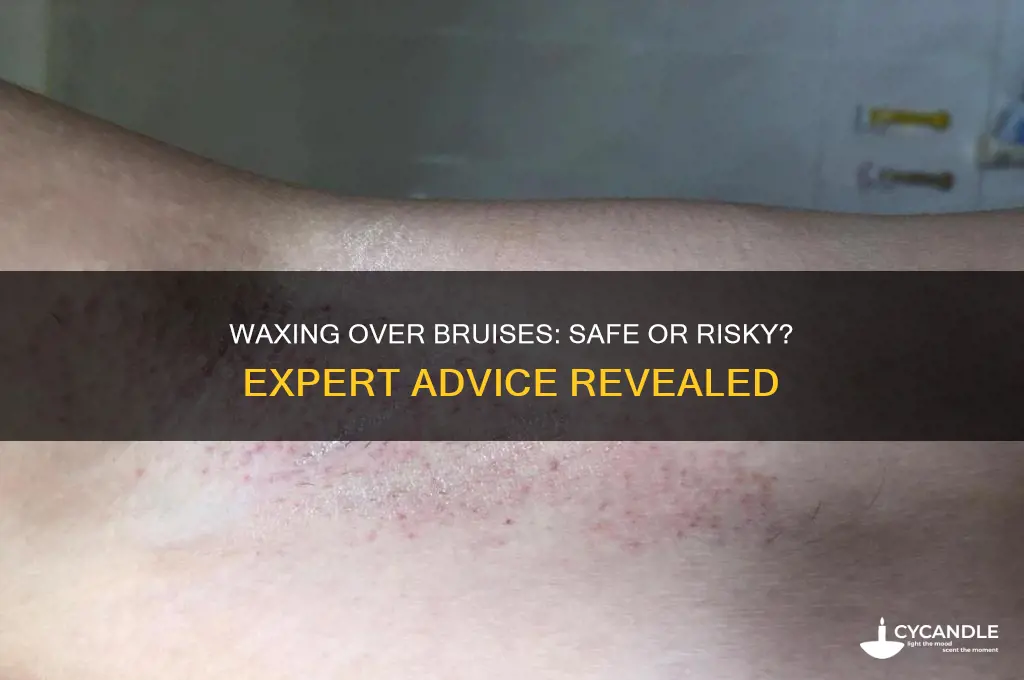 can you wax over a bruise