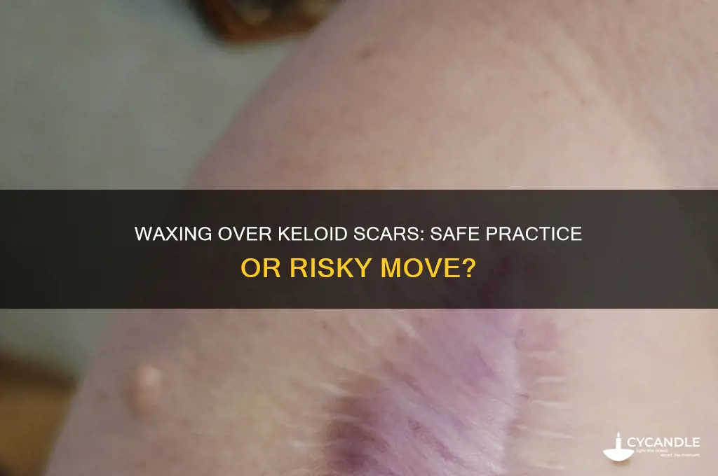 can you wax over a keloid scar