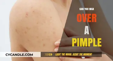 Waxing Over Pimples: Safe Practice or Skin Care Mistake?