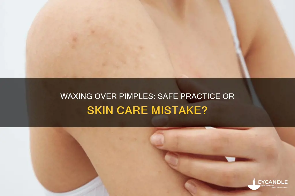 can you wax over a pimple