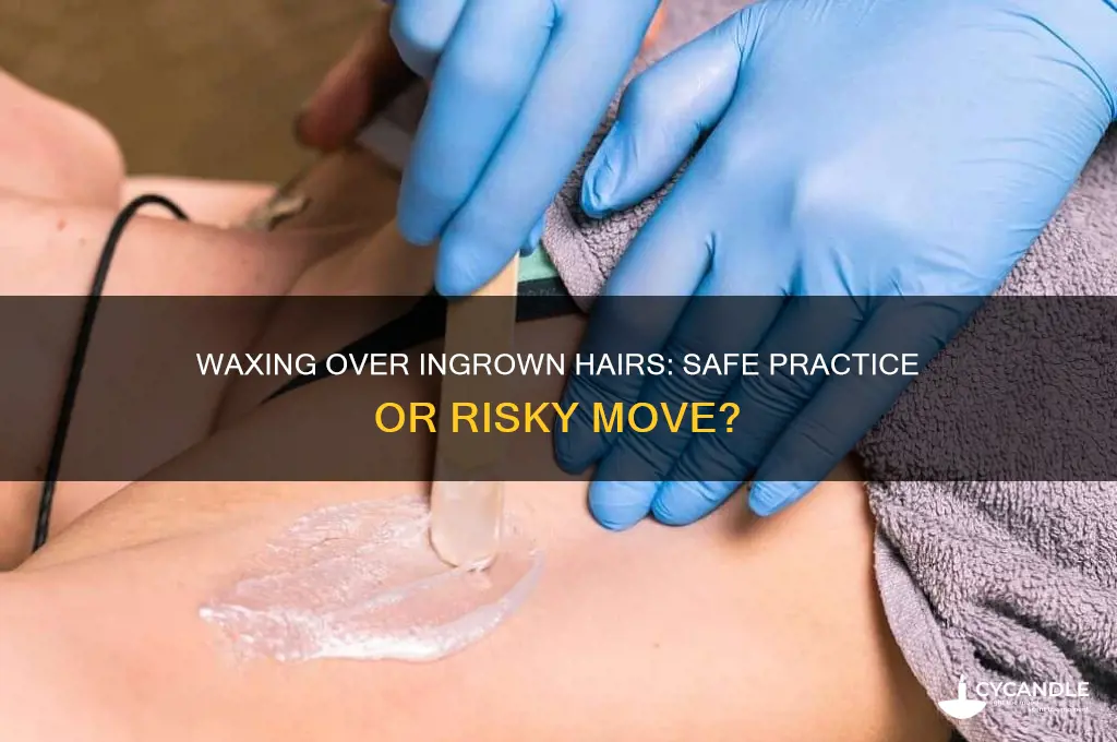 can you wax over ingrown hairs