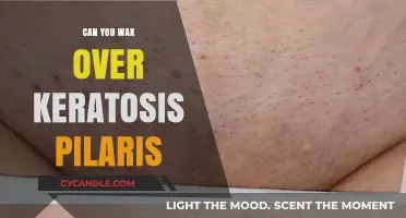 Waxing Over Keratosis Pilaris: Safe, Effective, or Skin Risk?