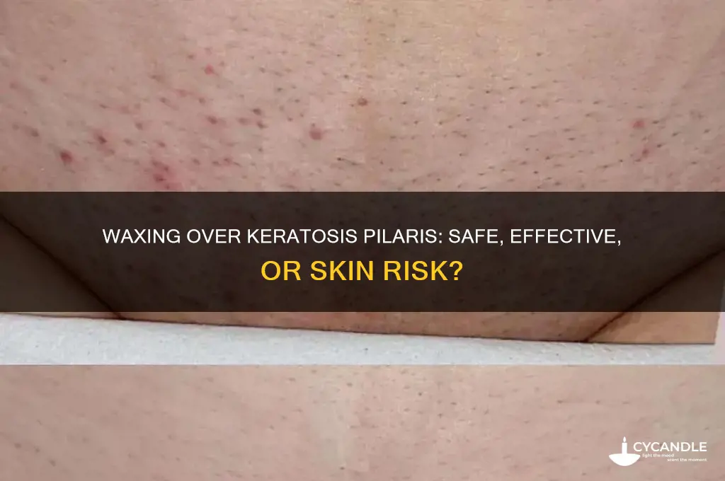 can you wax over keratosis pilaris