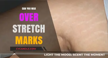 Waxing Over Stretch Marks: Safe, Effective, or Skin Risk?