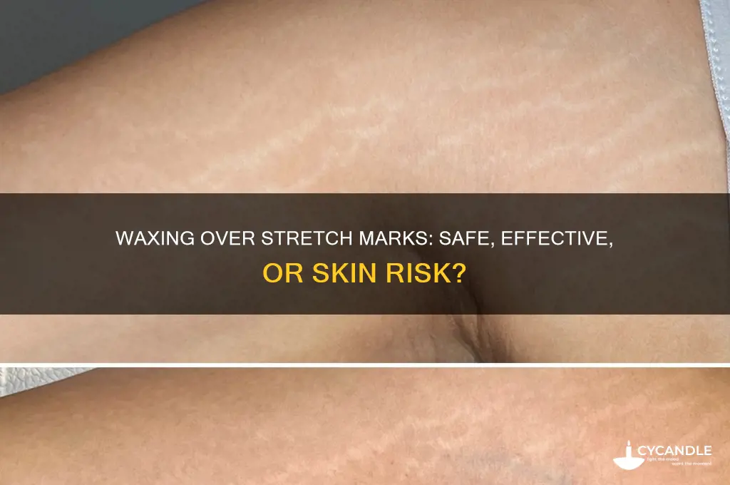 can you wax over stretch marks