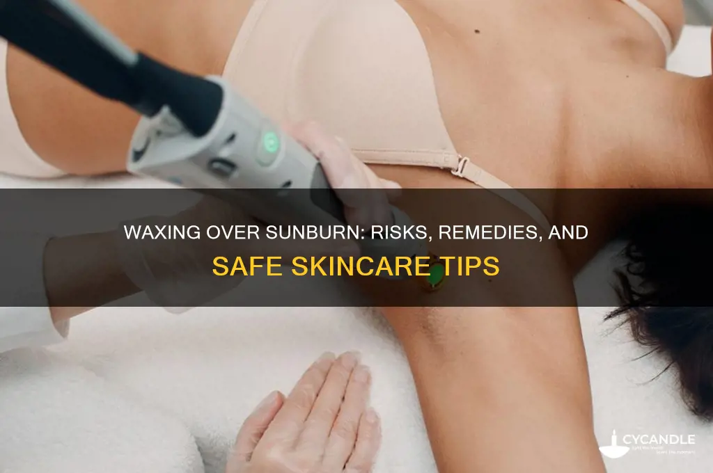 can you wax over sunburn