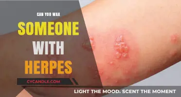 Waxing with Herpes: Safety, Risks, and What You Need to Know