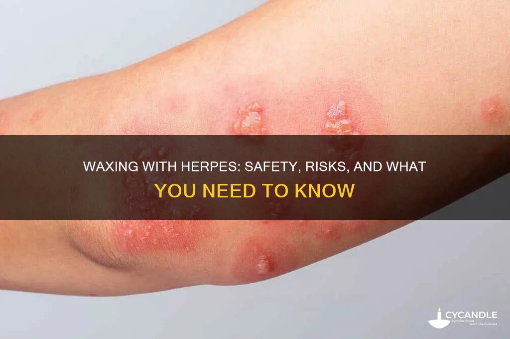 can you wax someone with herpes