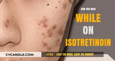 Waxing on Isotretinoin: Safe or Risky? Expert Advice