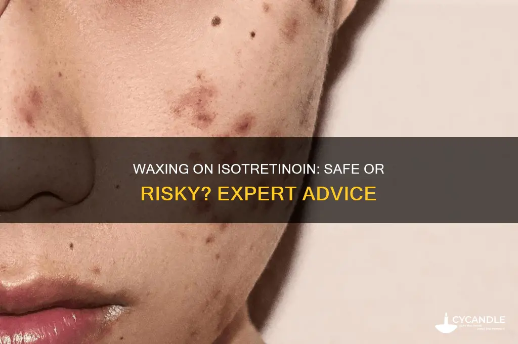 can you wax while on isotretinoin