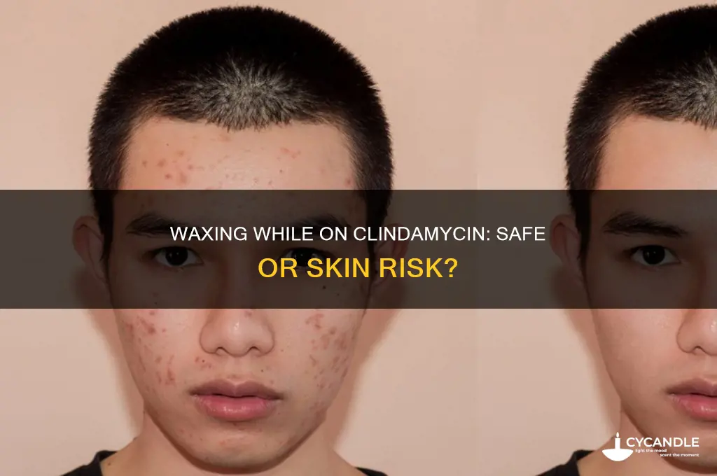 can you wax while using clindamycin