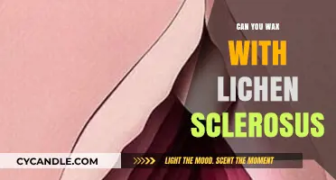 Waxing with Lichen Sclerosus: Safe Practices and Expert Advice