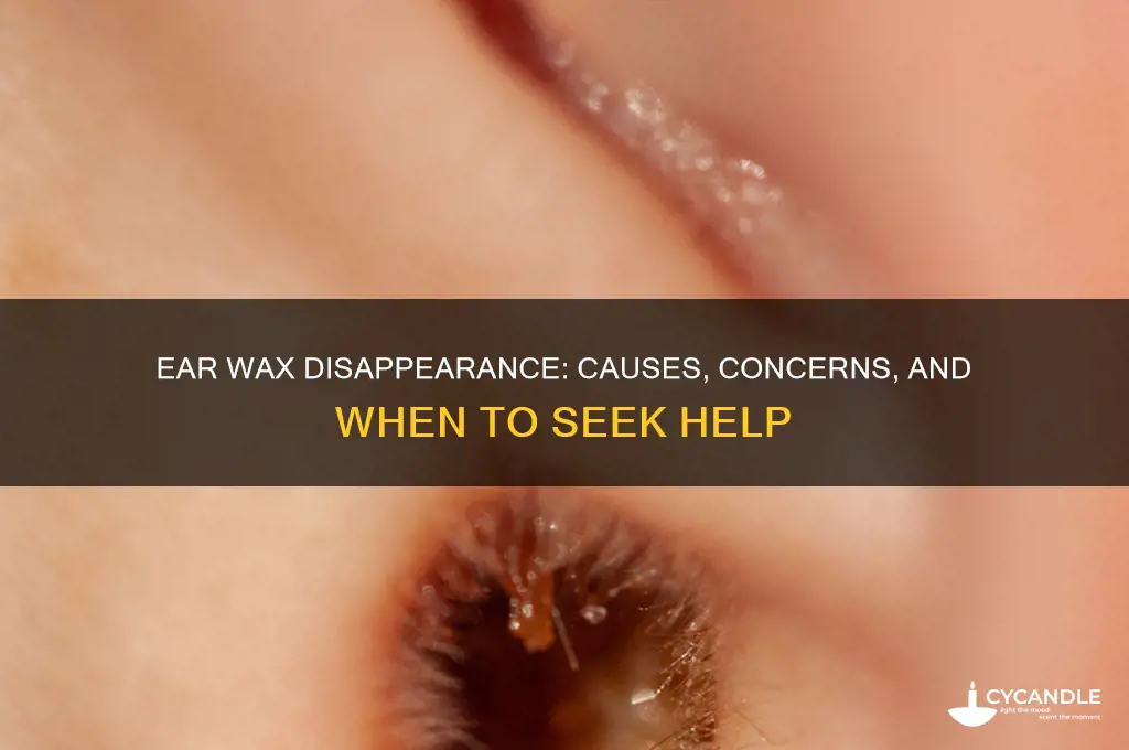 can your ear wax disappear