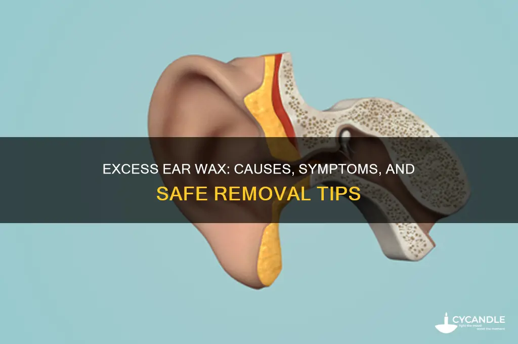 can your ears produce too much wax