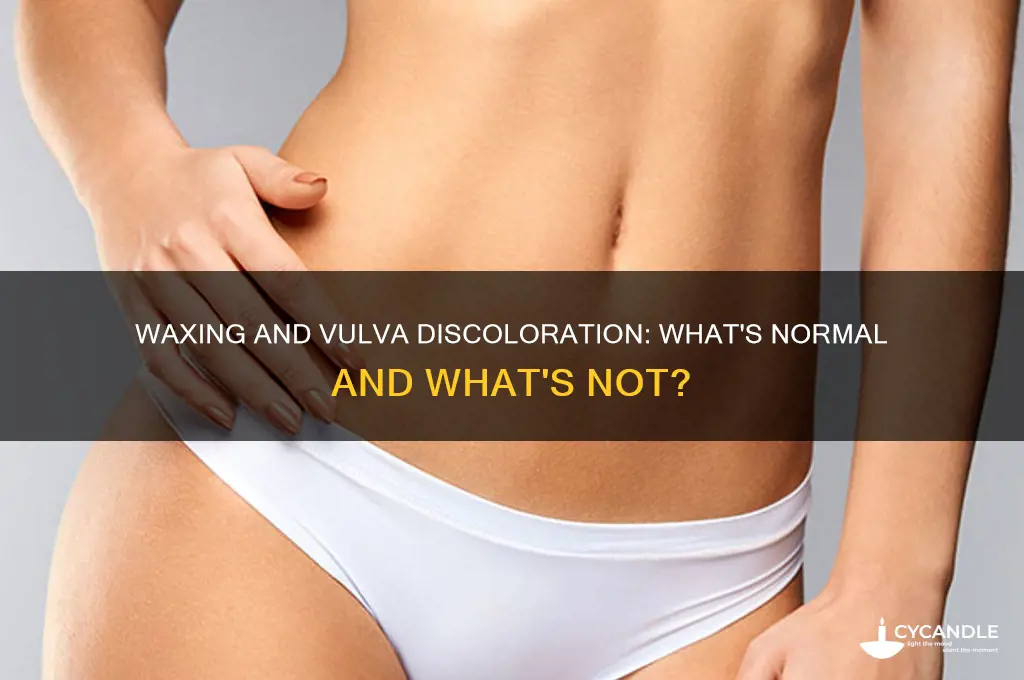 can your hooha get dark because of waxing
