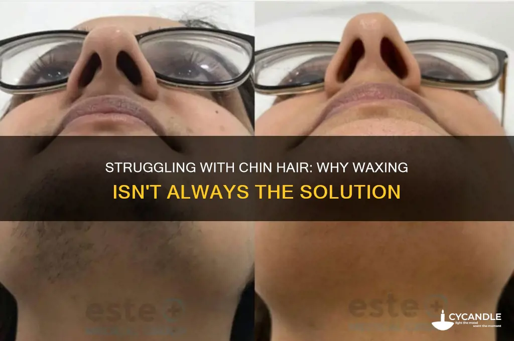 can