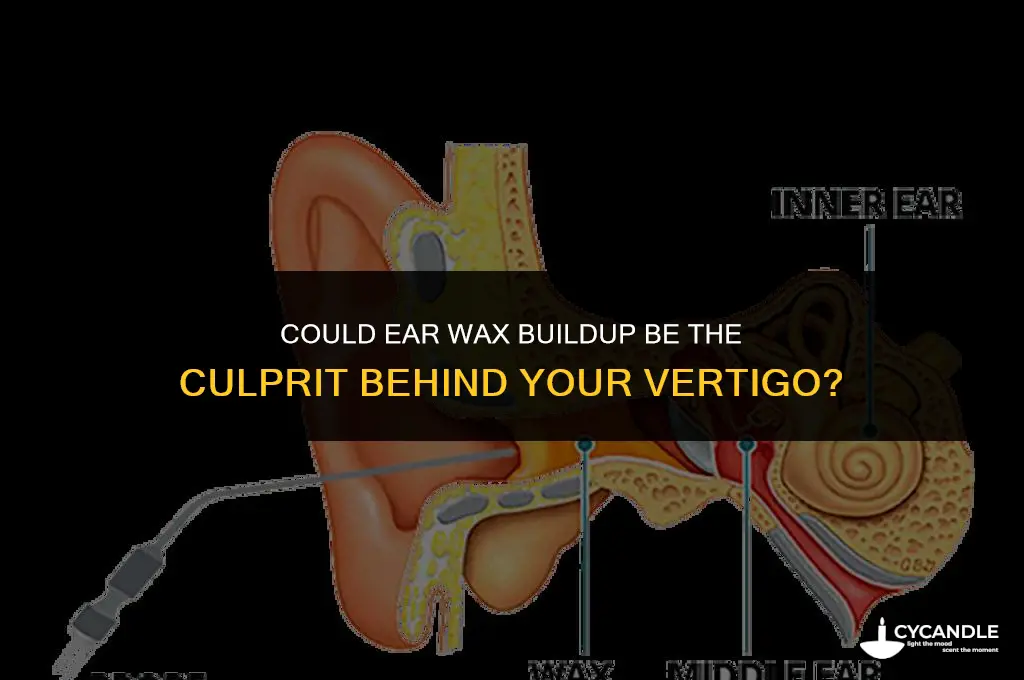could ear wax cause vertigo
