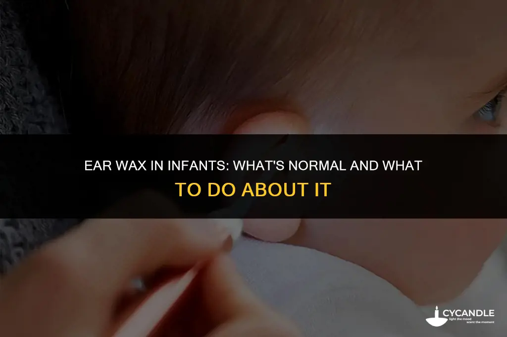 do babies get ear wax