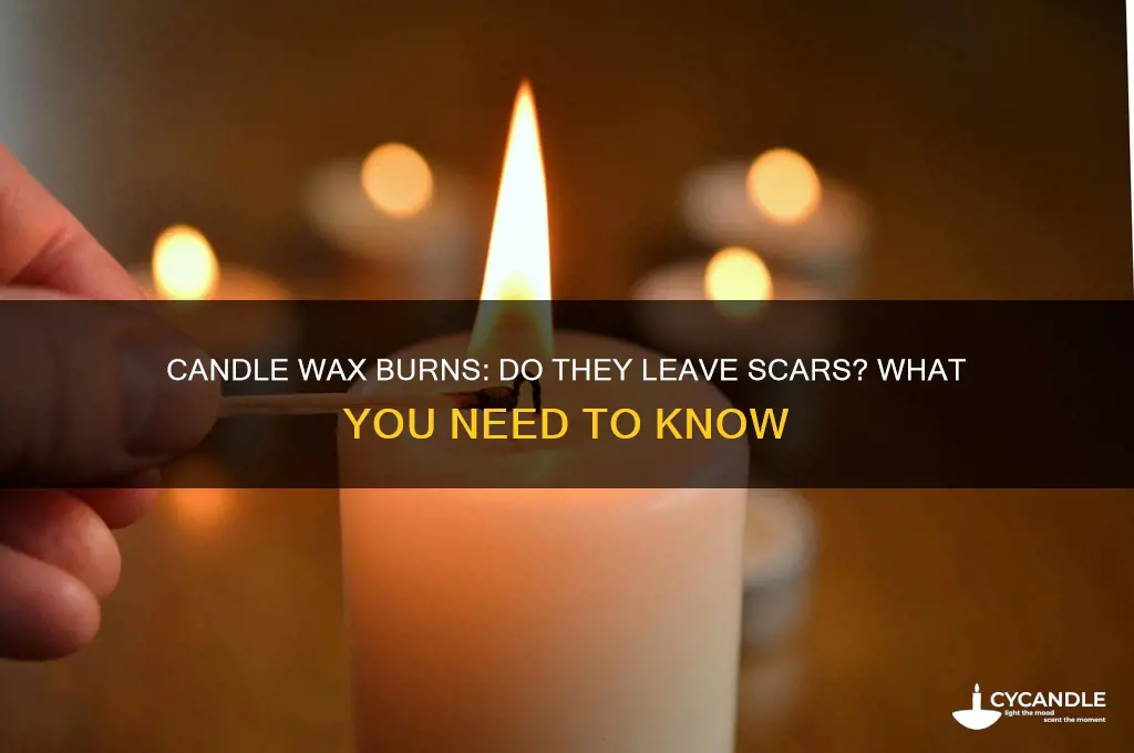 do candle wax burns scar