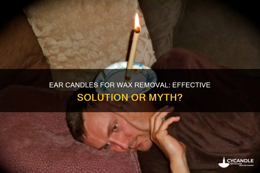do ear candles get rid of wax