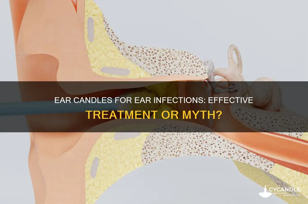 do ear candles work ear infections