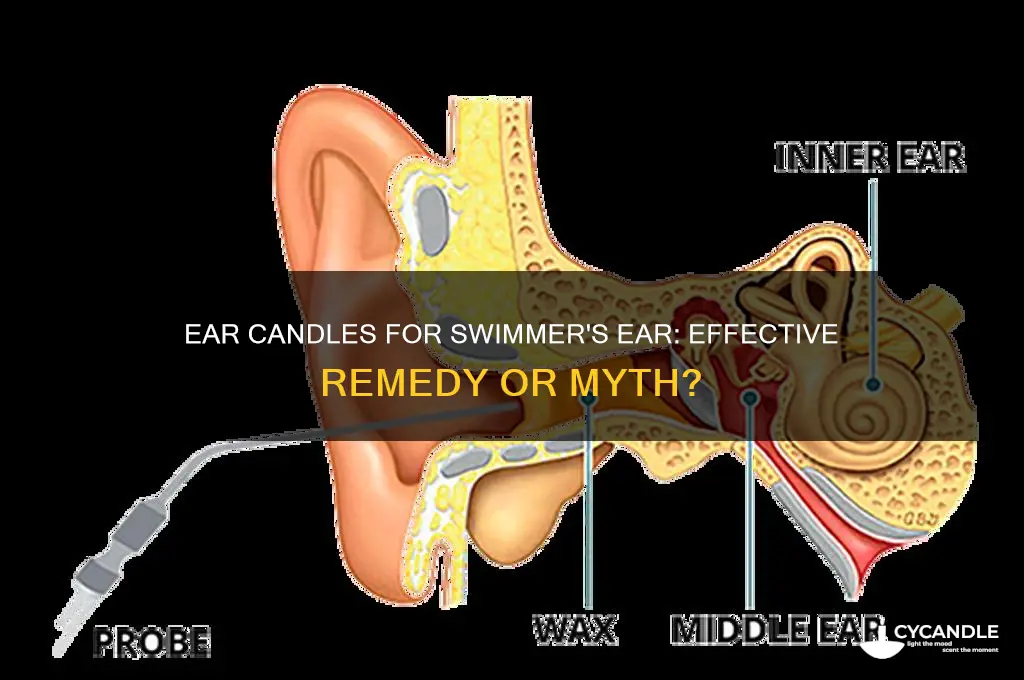 do ear candles work for swimmers ear