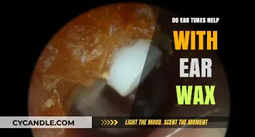 Ear Tubes and Ear Wax: What You Need to Know