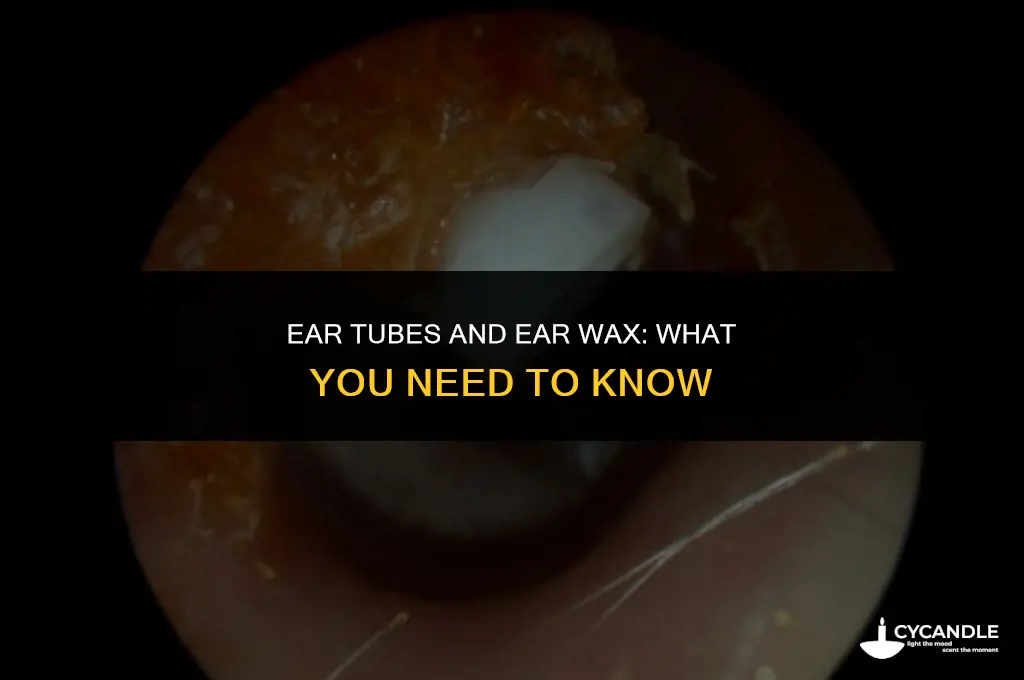 do ear tubes help with ear wax