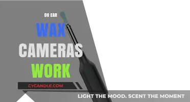 Unclogging the Truth: Do Ear Wax Cameras Really Work?