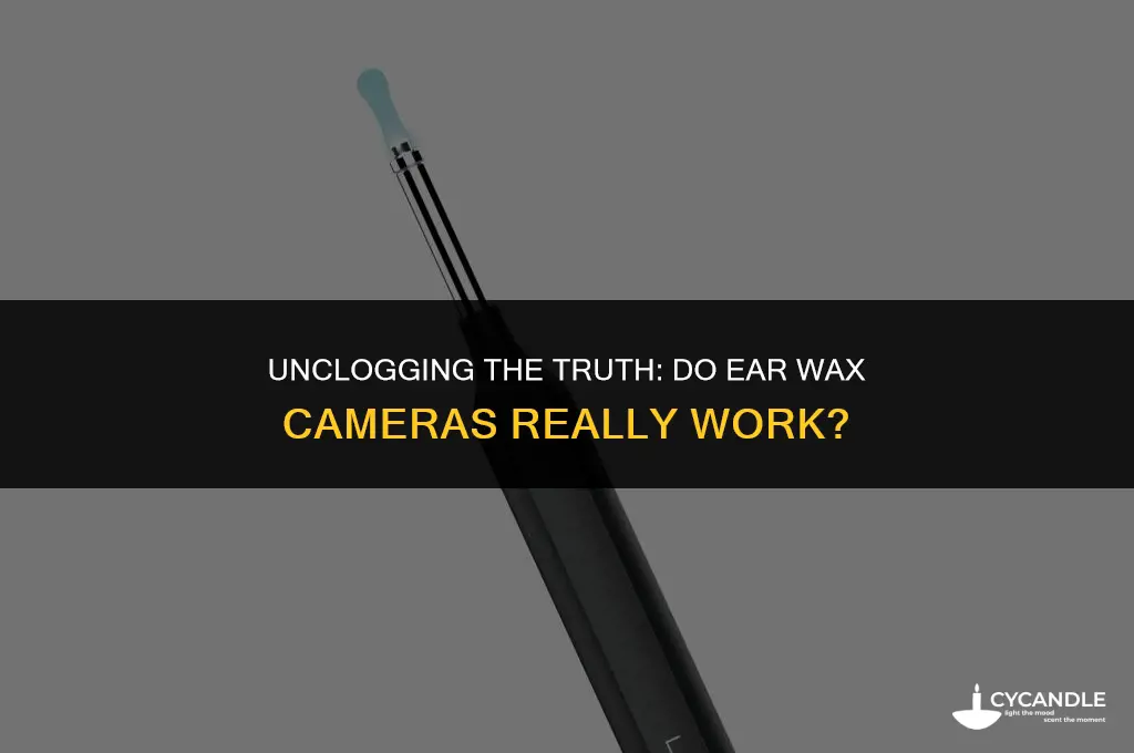 do ear wax cameras work