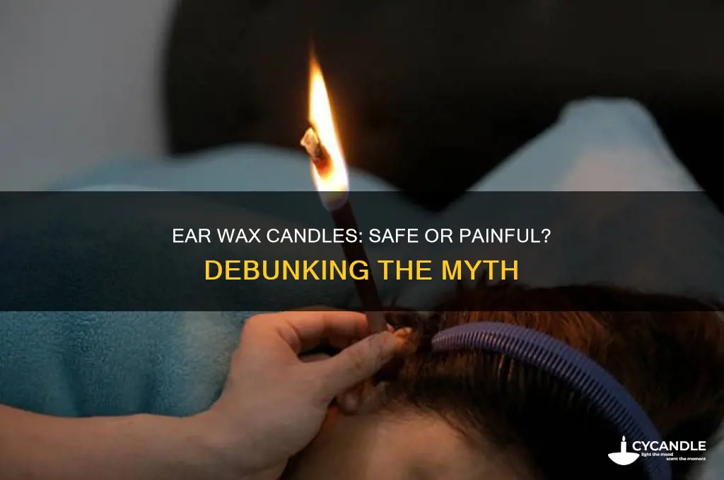 do ear wax candles hurt